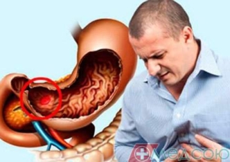Чим загрожує маленька ранка в шлунку?
