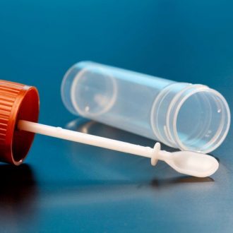 З 19.11.2020 у лабораторії клініки «Мед-Союз» пацієнти зможуть здати аналіз калу на приховану кров.