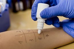 Allergy tests (all types of tests)