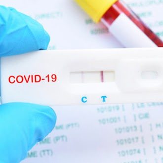 Экспресс-обследование на антиген COVID-19